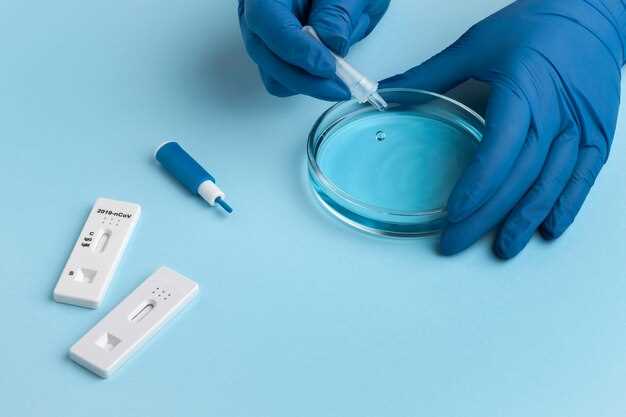 Hydroxyzine blood test